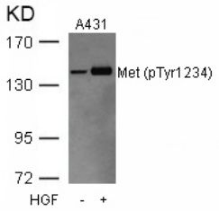 MET Antibody