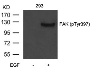 PTK2 Antibody
