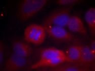 TH Antibody