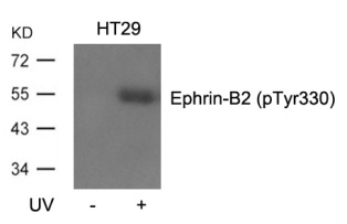 EFNB2 Antibody