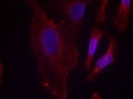 PLCG2 Antibody