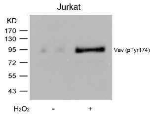 VAV1 Antibody