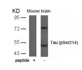 MAPT Antibody