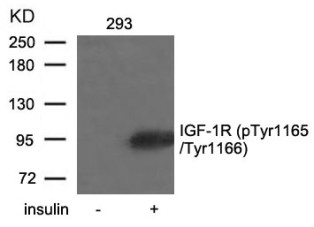 IGF1R Antibody