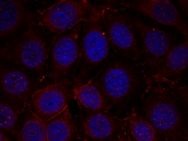 IGF1R Antibody