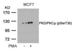 PKD / PKCmu (phospho Ser738) Antibody