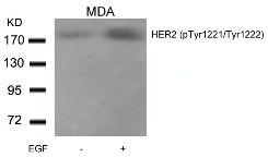 ERBB2 Antibody