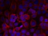 ERBB2 Antibody