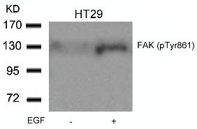 PTK2 Antibody