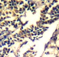 CBL Antibody