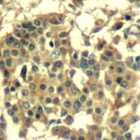 MET Antibody