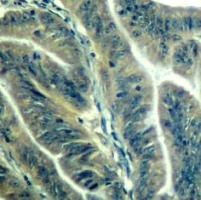 CDK6 Antibody