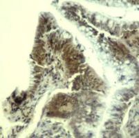 CDK6 Antibody