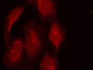 CDK6 Antibody