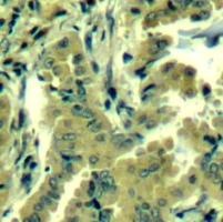 PLCG2 Antibody