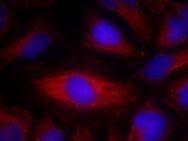 PLCG2 Antibody