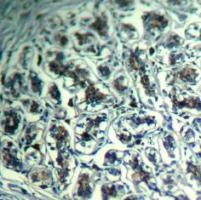 PLCG1 Antibody