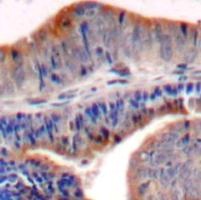 STMN1 Antibody