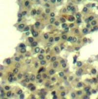 Her3 / ErbB3 (Ab 1328) Antibody
