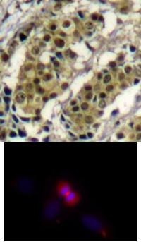 AKT1 Antibody