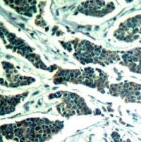 AKT1 / AKT2 / AKT3 (Ab 315 / 316 / 312) Antibody