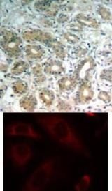 PTPN11 Antibody