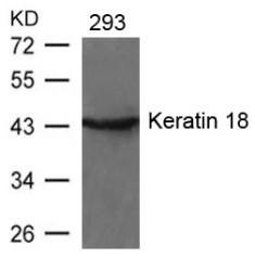 KRT18 Antibody