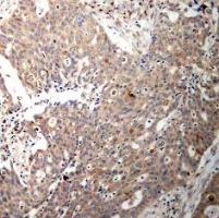 KRT18 Antibody