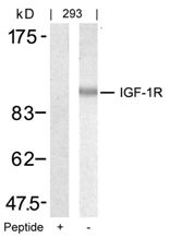 IGF1R Antibody