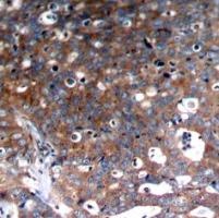 IGF1R Antibody