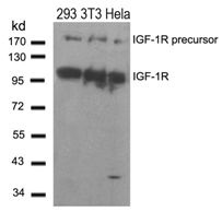 IGF1R Antibody