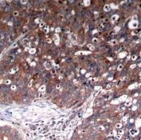 IGF1R Antibody