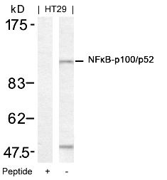 NFKB2 Antibody