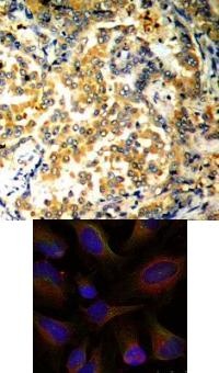 NFKB2 Antibody
