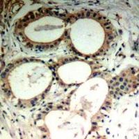NFKBIE Antibody