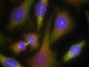 PKR (Ab 451) Antibody