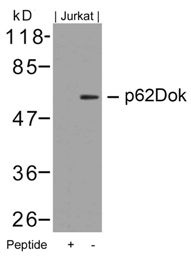 DOK1 Antibody