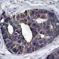 DOK1 Antibody