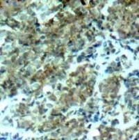CTTN Antibody