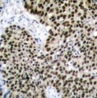 HSF1 Antibody