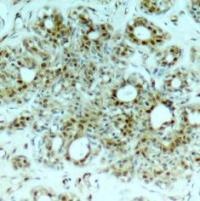 RELA Antibody