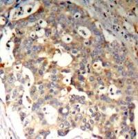 MAPK9 Antibody