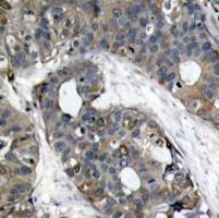HSP27 (Ab 82) Antibody