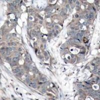 HSP27 (Ab 78) Antibody