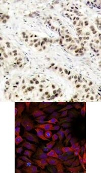 CDK1 Antibody