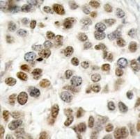 BRCA1 Antibody
