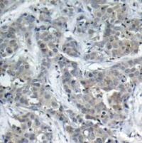 STMN1 Antibody