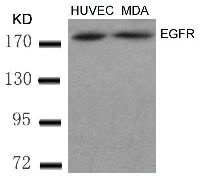 EGFR (Ab 869) Antibody