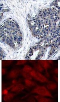 STMN1 Antibody