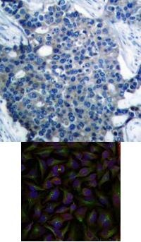 Stathmin 1 (Ab 25) Antibody
